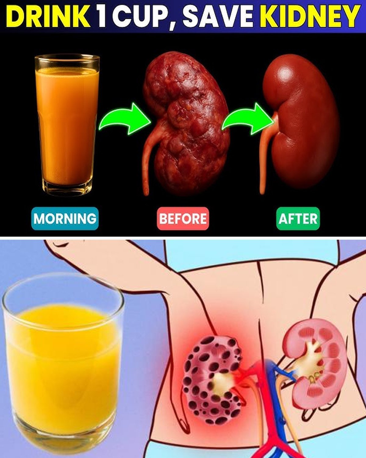 Just 1 Cup a Day and Your Kidneys Could Start Recovering Naturally