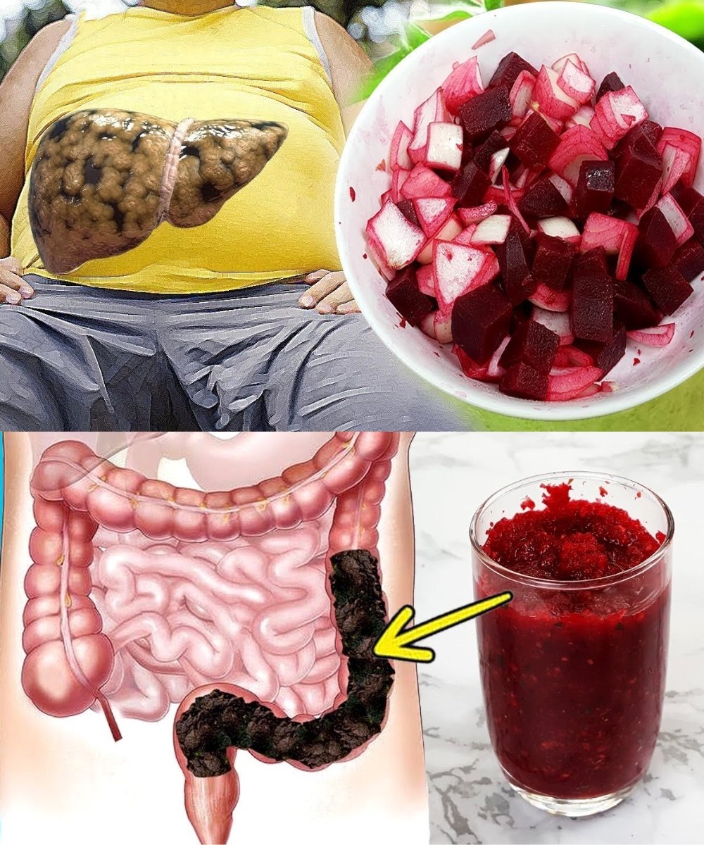 Cleanse Your Colon Naturally & Remove Fat from Your Liver with This Beetroot and Onion Drink