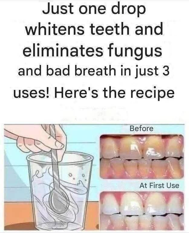 Remove tartar from your teeth and whiten them with thi
