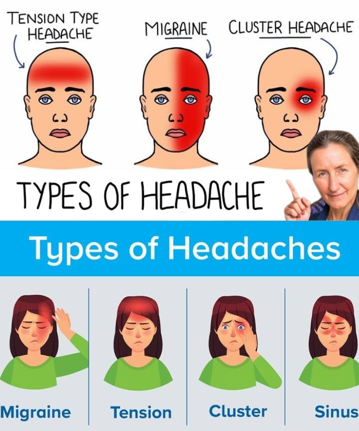 10 Different Types of Headaches and Their Causes (Plus Natural Remedies)