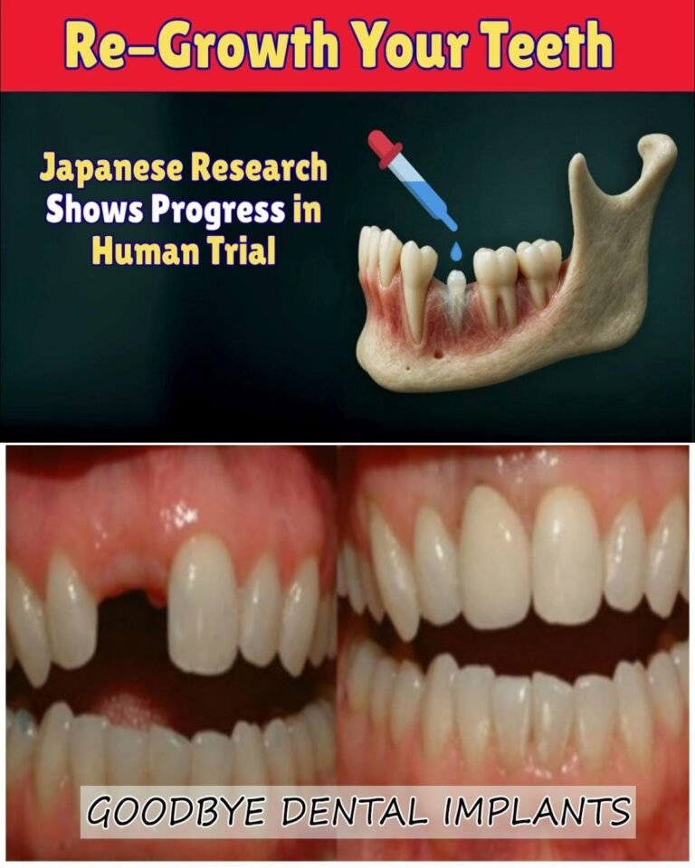 Natural Tooth Regeneration: Is This the End of Dental Implants?