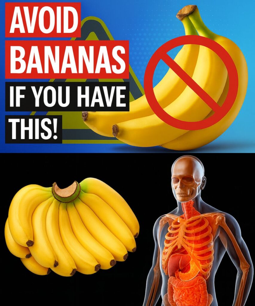 AVOID Bananas If You Suffer From These 5 Health Problems!
