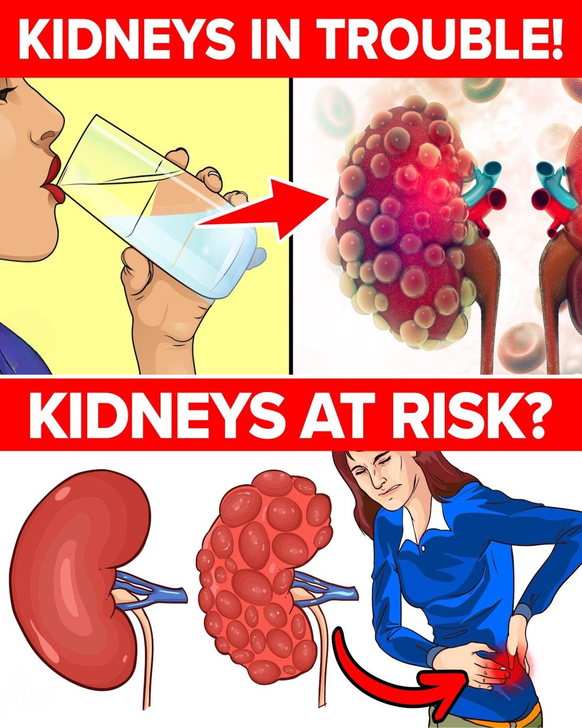 7 Innocent Mistakes That Get Your Kidneys in Big Trouble