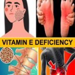 5 Signs Your Body Is Begging for Vitamin E