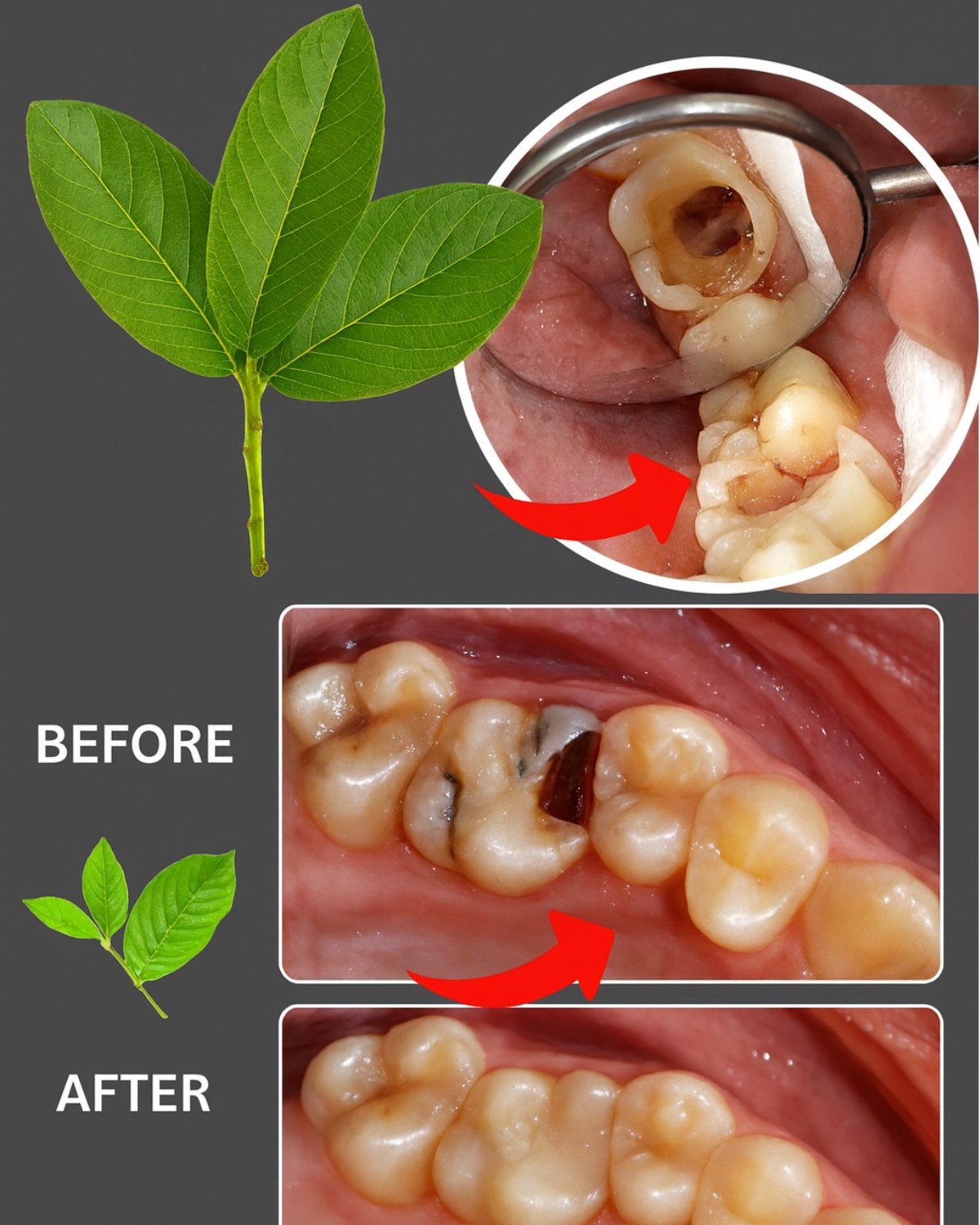 Guava Leaves for a Radiant Smile: A 70-Year-Old Grandma’s Time-Tested Secret