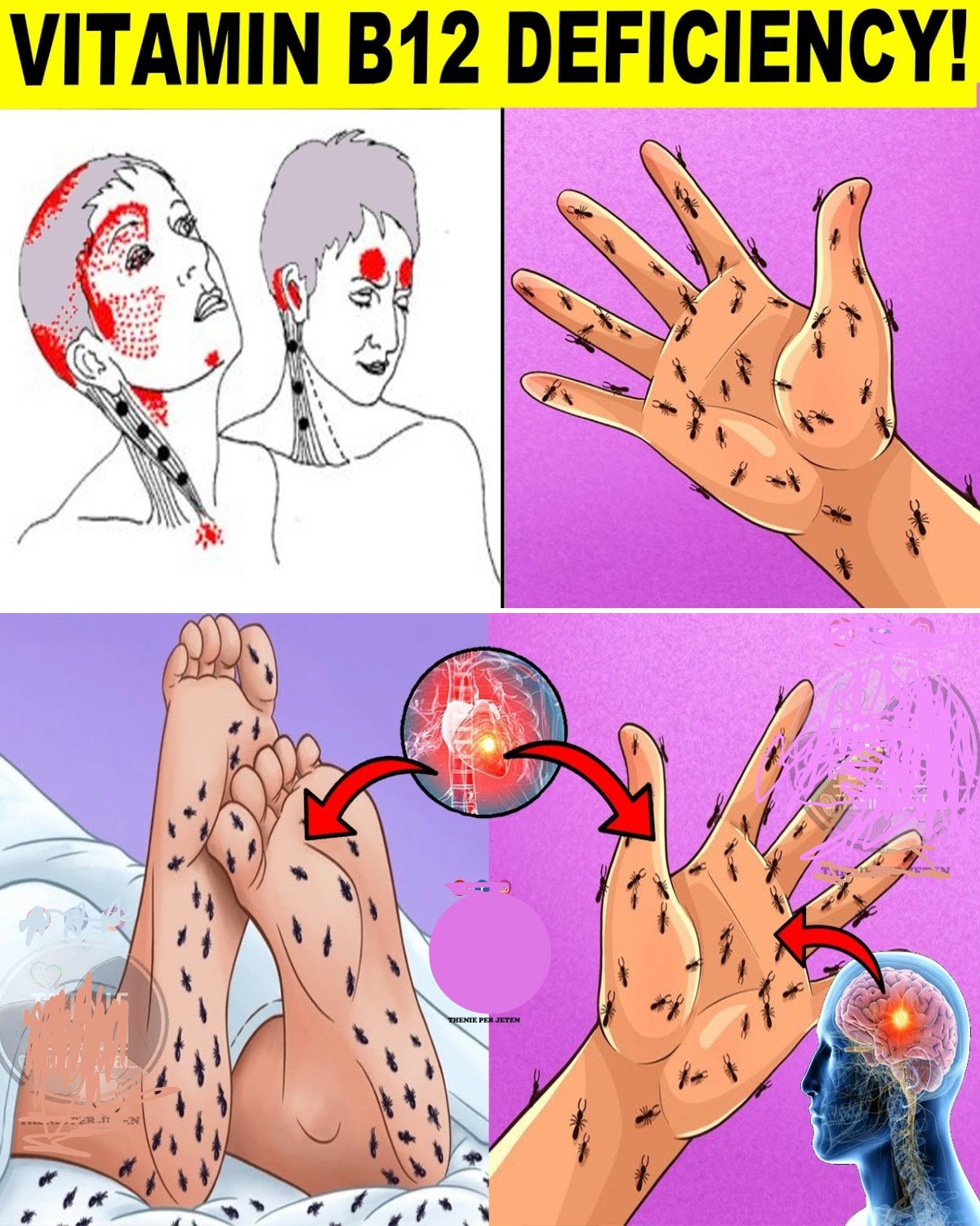 Vitamin B12 Deficiency Symptoms That Should Never Be Ignored