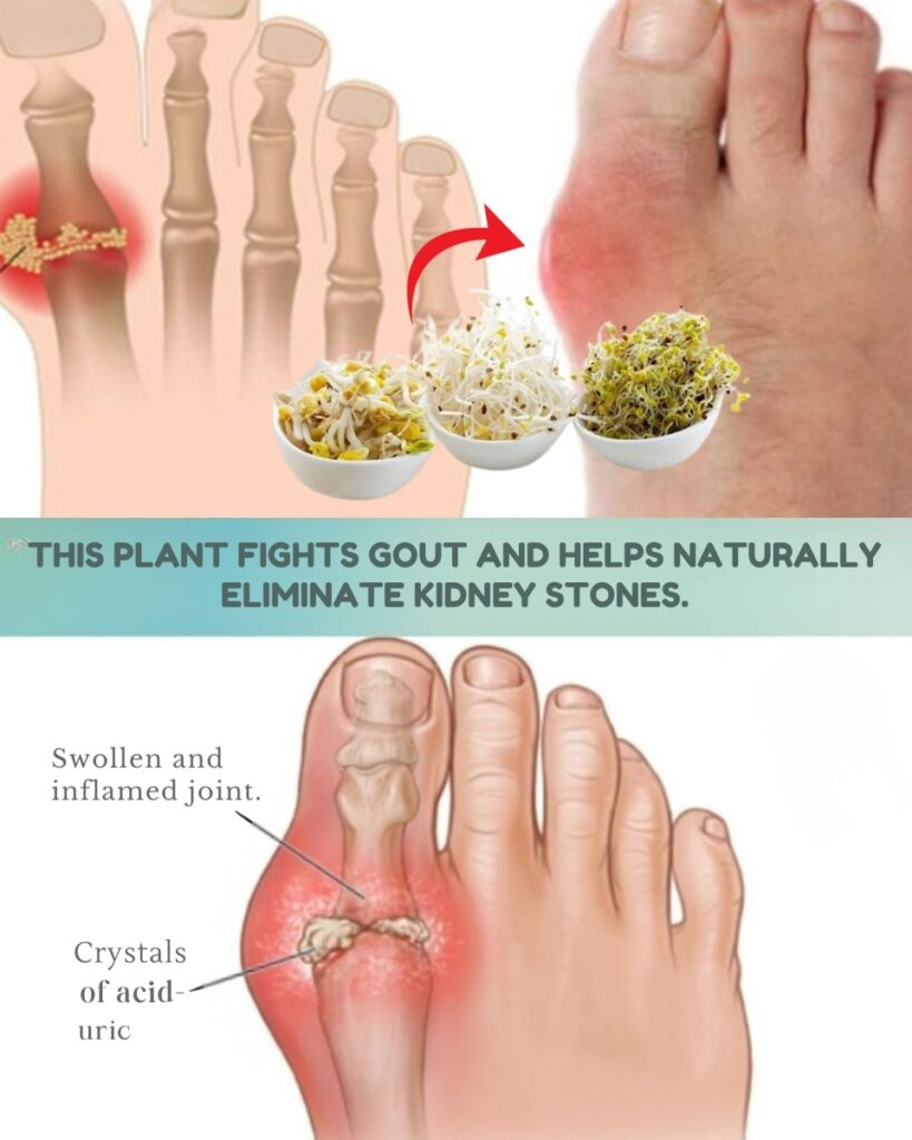 Alfalfa for Kidneys & Gout: A Gentle, Natural Support