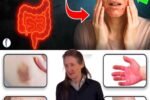 5 Shocking Skin Signs That Your Gut Is In Trouble – What Your Face Is Begging You to Notice