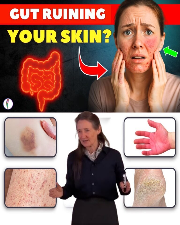 5 Shocking Skin Signs That Your Gut Is In Trouble – What Your Face Is Begging You to Notice