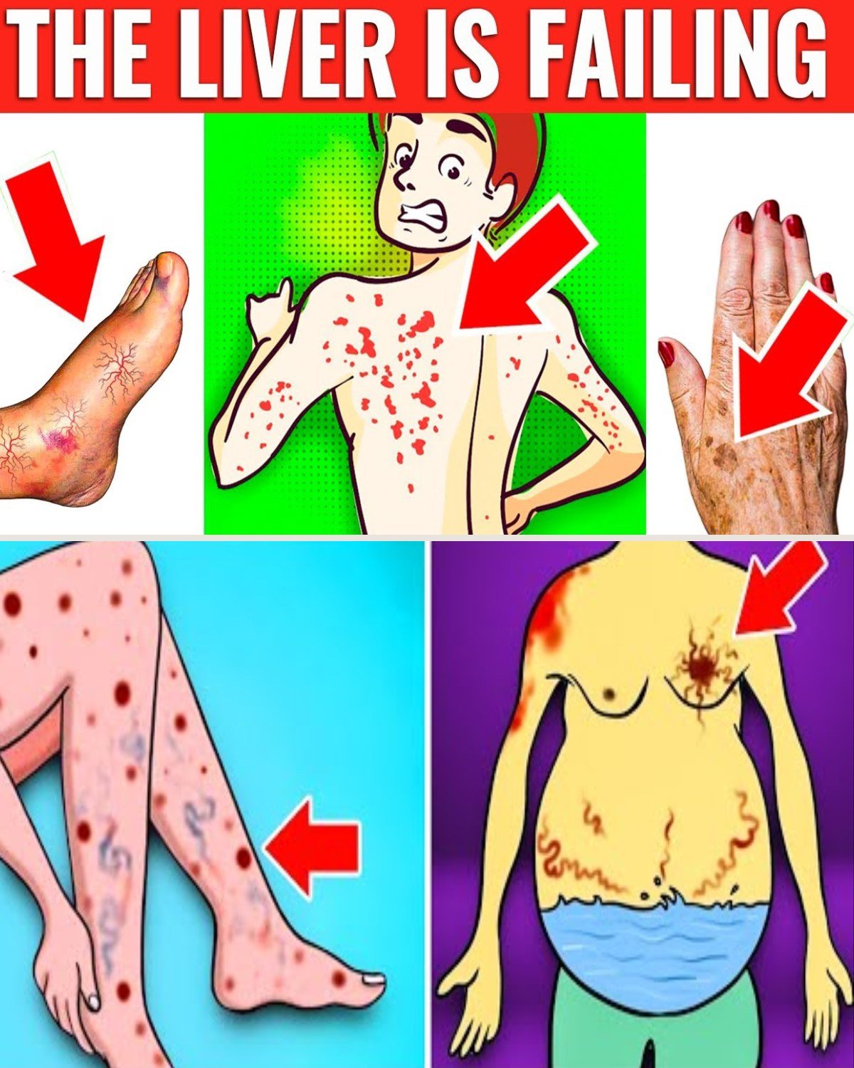 10 Silent Signs Your Liver Is Crying for Help
