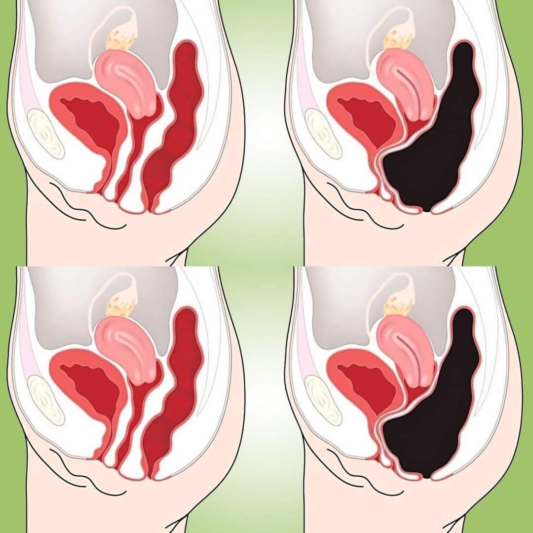 How to Cleanse Your Colon Naturally at Home (Colon Cleanse Smoothie)