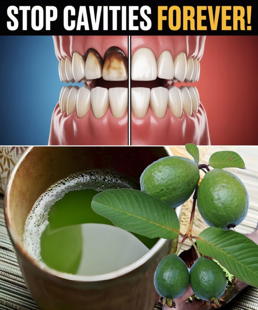 Stop Cavities Forever with Guava Leaf Power: Nature’s Secret to Strong, Healthy Teeth
