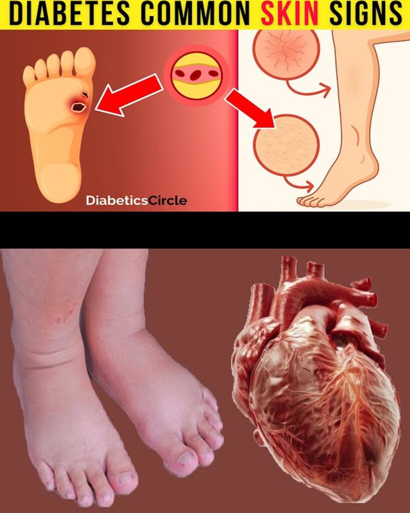 12 Hidden Signs of Congestive Heart Failure Lurking in Your Legs and Feet