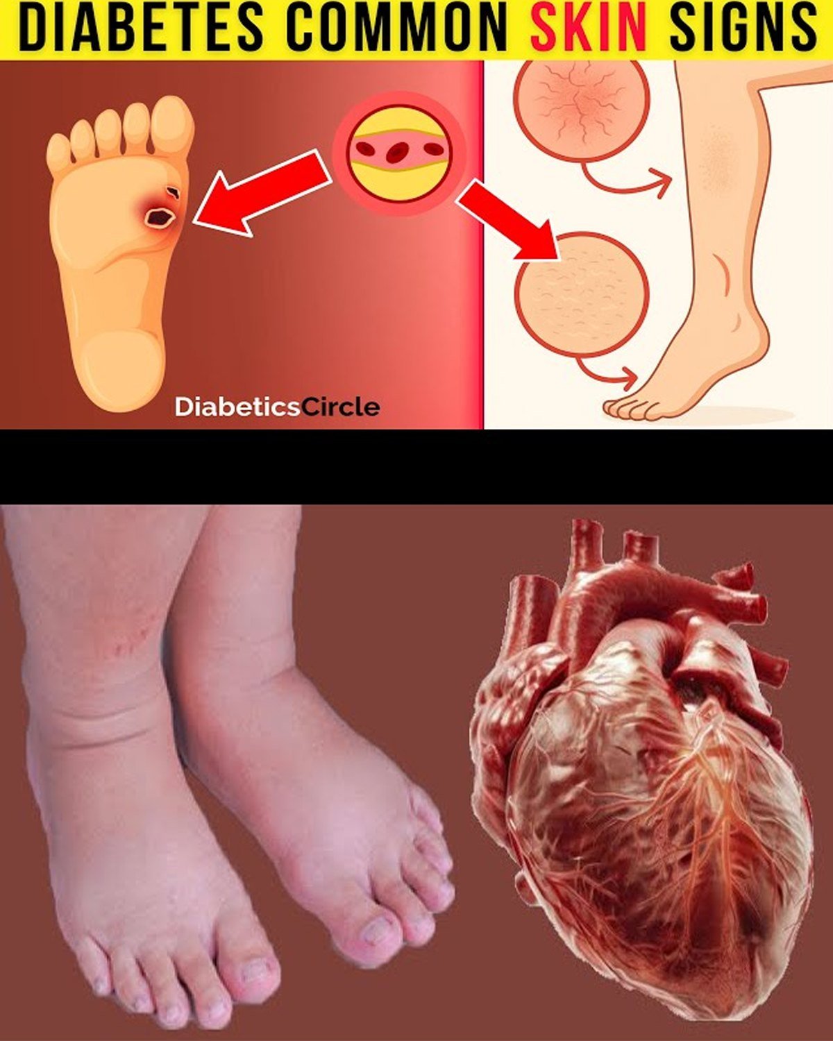 12 Hidden Signs of Congestive Heart Failure Lurking in Your Legs and Feet
