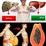 Papaya Seeds: The Natural Remedy Few Know About