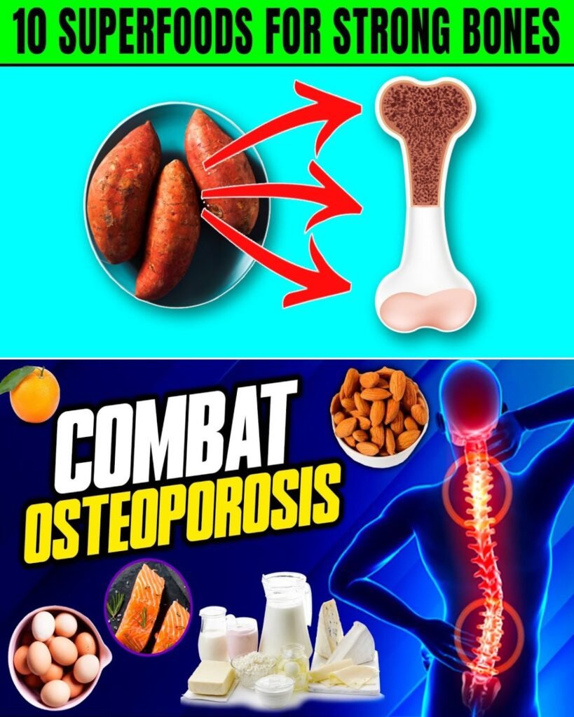 10 Superfoods for Strong Bones and Preventing Osteoporosis
