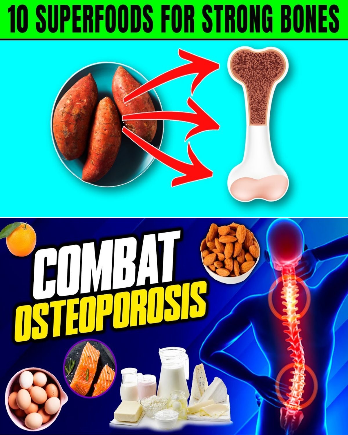 10 Superfoods for Strong Bones and Preventing Osteoporosis