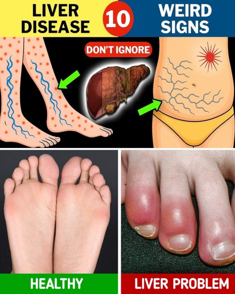 Warning: 12 Weird Signs That Show You’re Having Liver Damage
