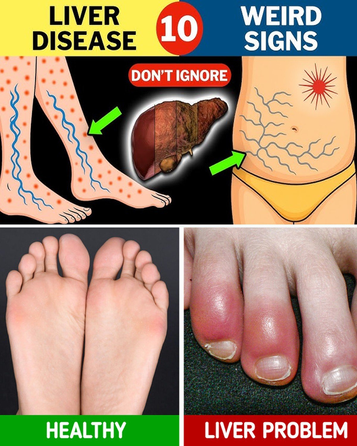 Warning: 12 Weird Signs That Show You’re Having Liver Damage