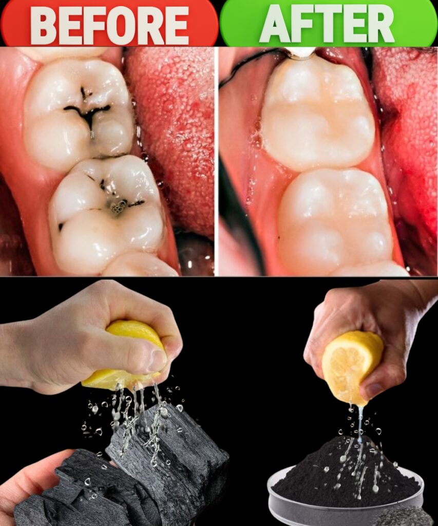 🌿 Natural Ways to Protect and Repair Your Teeth