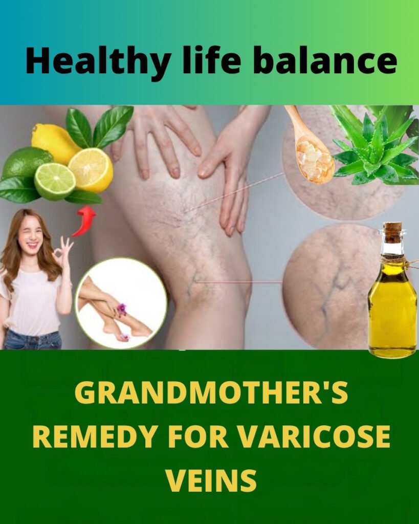 Grandma’s Natural Remedy for Varicose Veins: Aloe Vera, Apple Cider Vinegar & Lemon Recipe 💚
