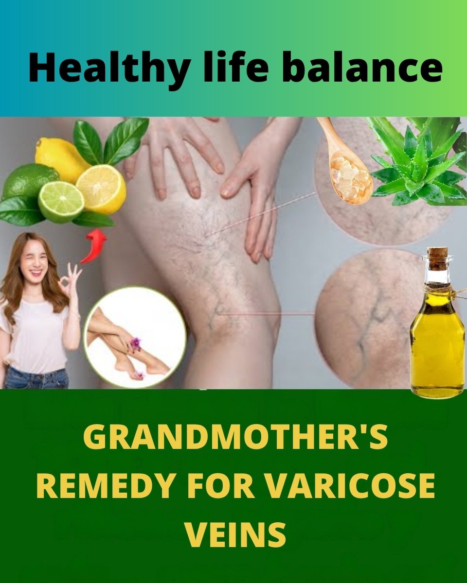 Grandma’s Natural Remedy for Varicose Veins: Aloe Vera, Apple Cider Vinegar & Lemon Recipe 💚