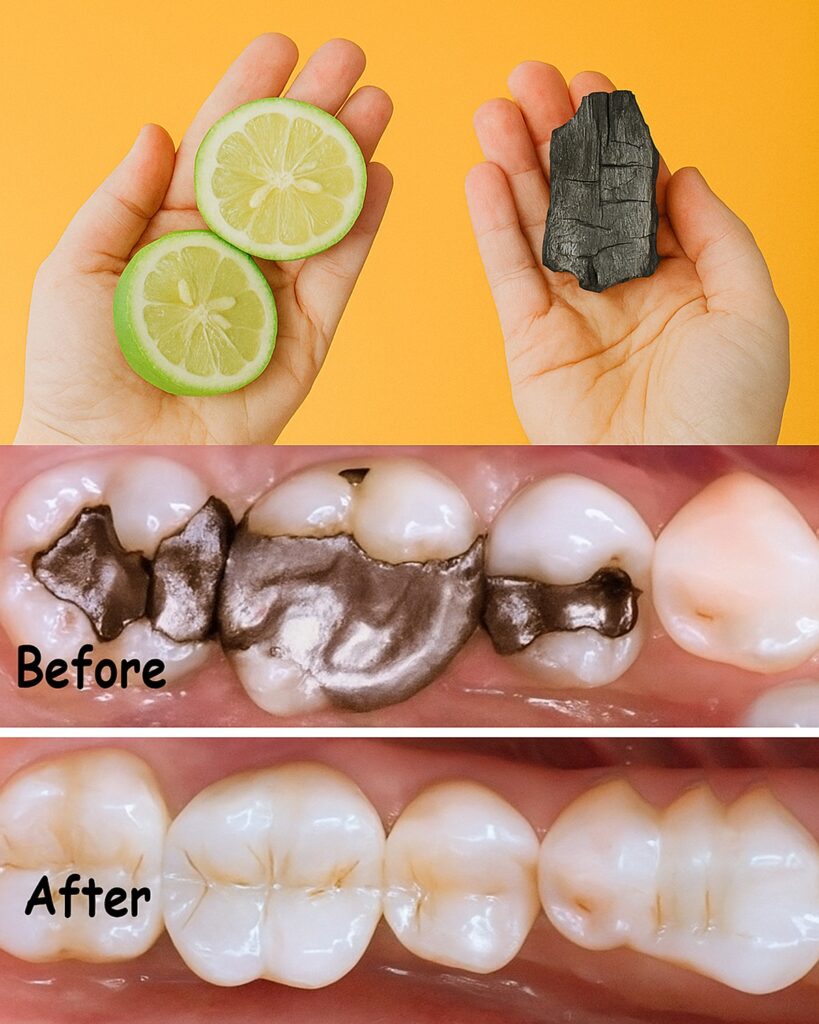 Never Get Cavities Again—The Secret Your Dentist Won’t Tell You!