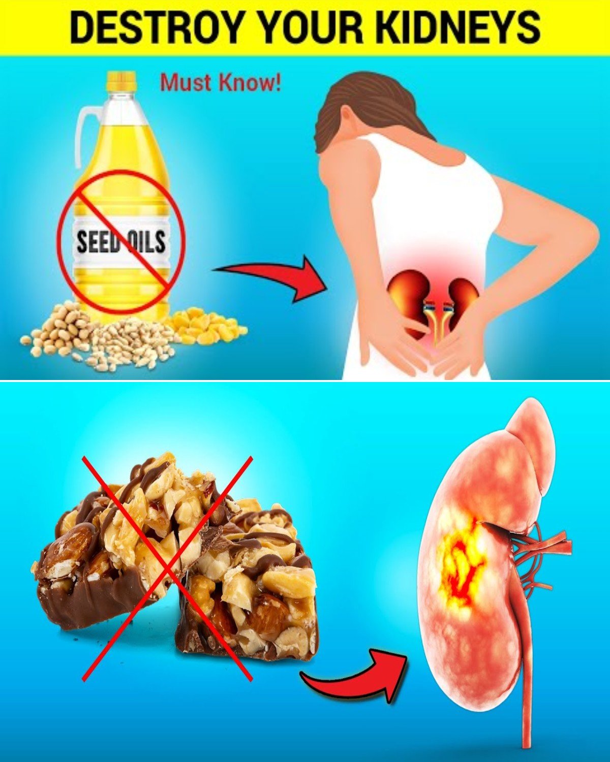 Avoid These 7 Plant-Based Foods That Can Damage Your Kidneys