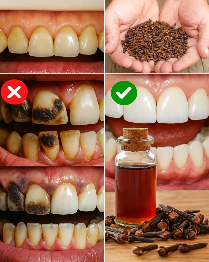 9 Natural Ways to Remove Plaque & Tartar Buildup: Your Teeth Will Thank You Tonight