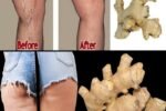 Seniors, Rub THIS 2-Ingredient Ginger Paste on Your Legs Tonight & Watch Varicose Veins Fade + Cellulite Dimples Vanish in 14 Nights