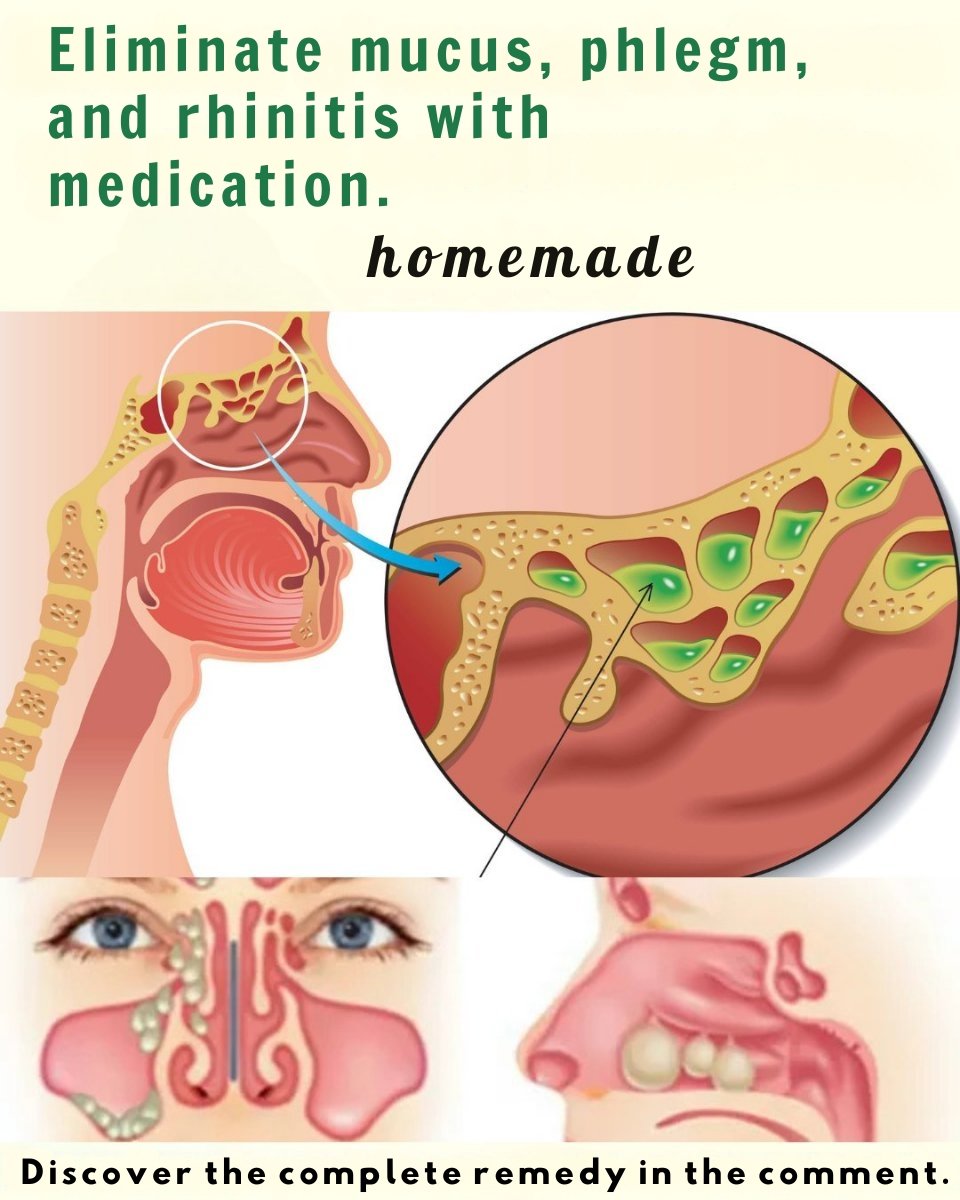 🌿 Mucus & Phlegm: 4 Gentle Home Remedies for Clearer Breathing