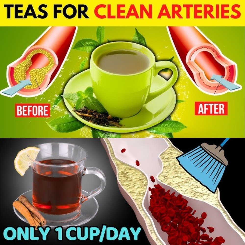 💚 Sip for Your Heart: 3 Gentle Teas That Support Healthy Arteries Naturally