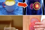 4 Bedtime Drinks That Help Repair Kidneys and LOWER Creatinine – Sleep Your Way to Stage 2 by Morning