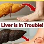 How Your Feet Are Warning You About Liver Problems: What You Need to Know