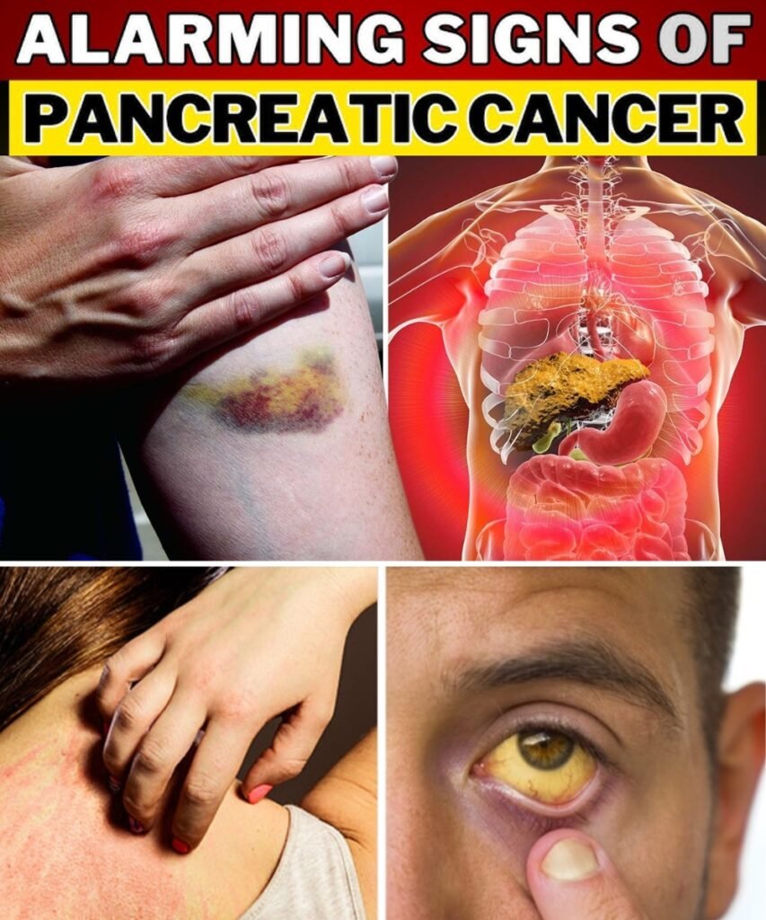 DON'T IGNORE! Top 8 Warning Signs Of Blood Clots