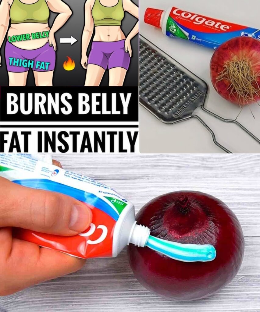 Lose Belly Fat Overnight: Onion + Toothpaste