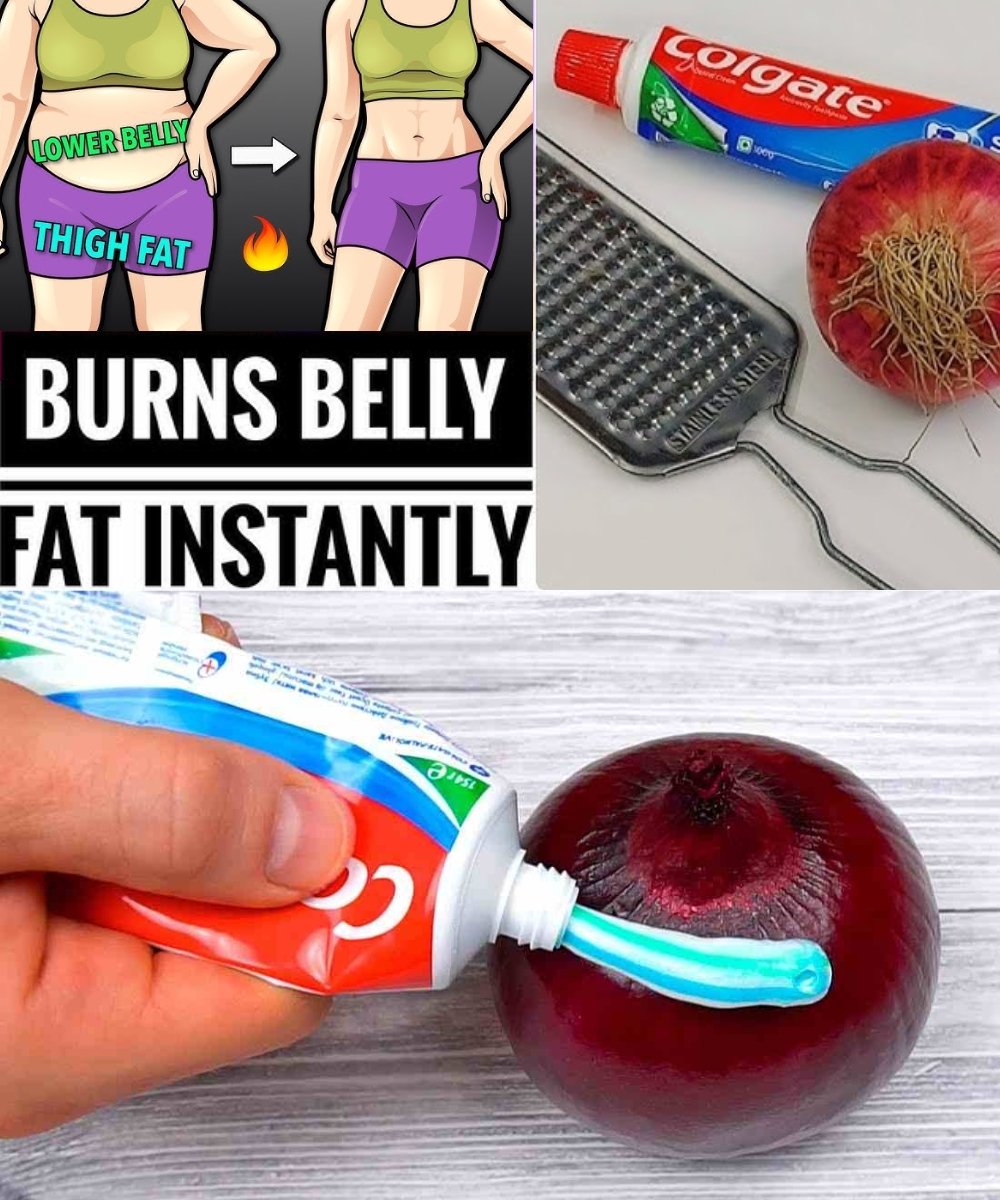 Lose Belly Fat Overnight: Onion + Toothpaste