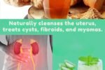 🌿 Natural Remedies for Cysts and Fibroids: Gentle Support for Women’s Health
