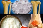 Eat This Every Day to Stop Knee Pain and Rebuild Cartilage