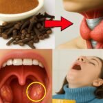 Cloves Unraveled: The Tiny Spice That Obliterates Sore Throats and Inflammation Overnight