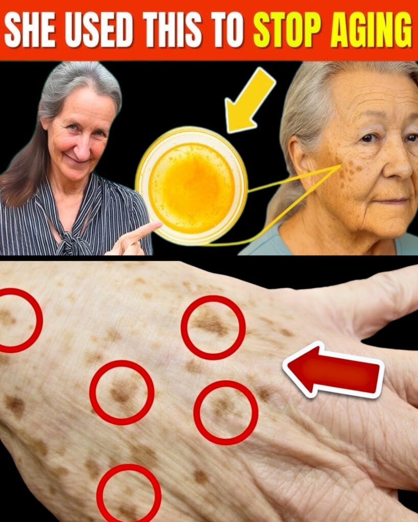 The Best Vitamin to Remove Age Spots — Revealed by Skin Experts