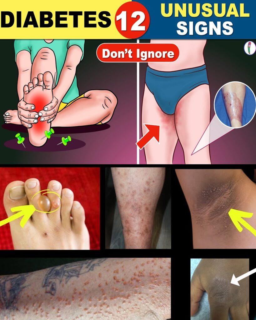 12 Unusual Symptoms of Diabetes | Diabetes Symptoms | Diabetes Mellitus | Diabetes Warning Signs