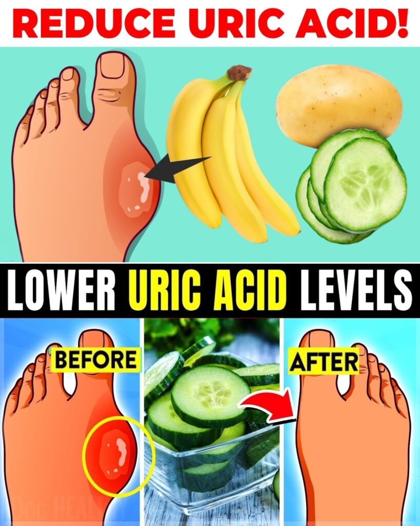 Top 8 Foods That Reduce Uric Acid Levels Naturally