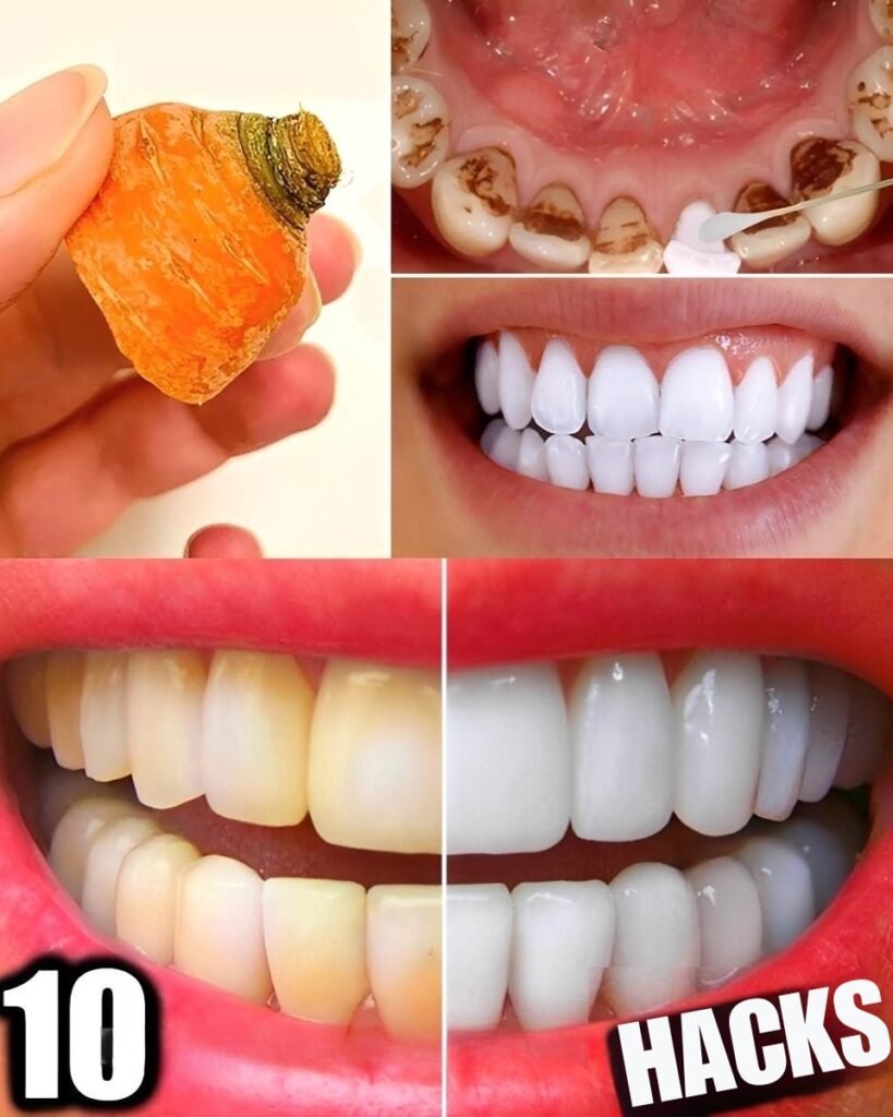 😁✨ 10 Natural Tricks to Whiten Your Teeth at Home in Just 3 Days (No Dentist Needed!) 🌿