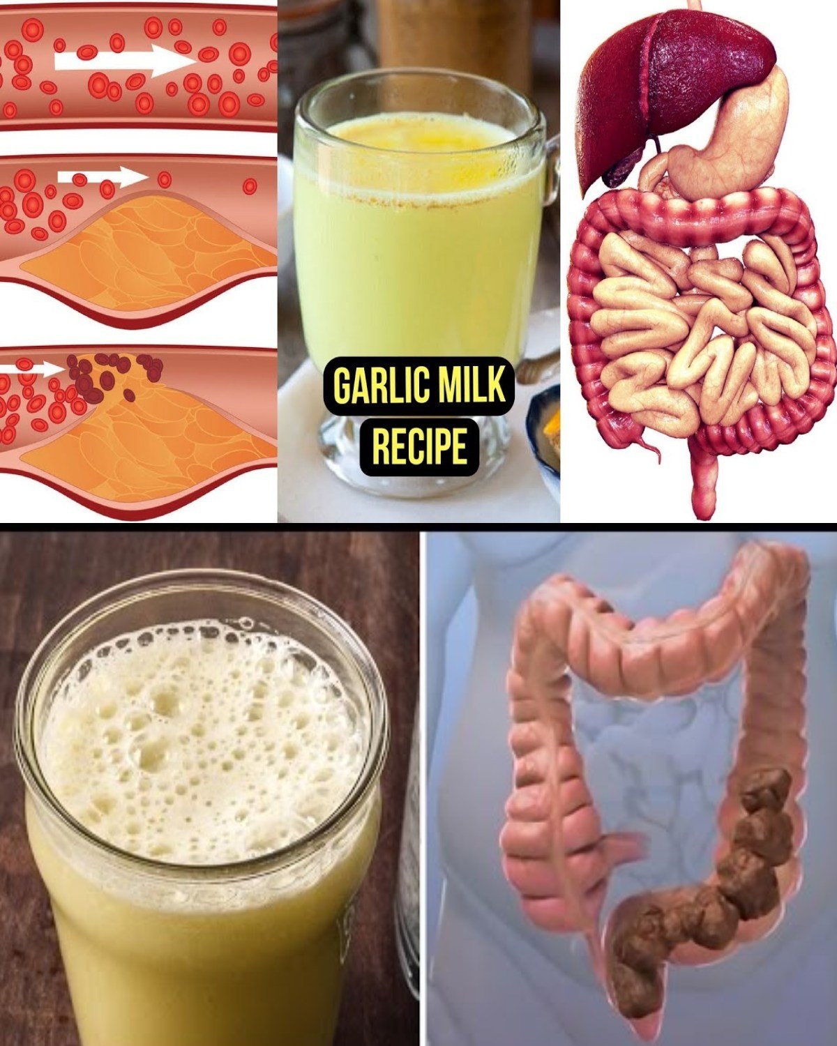 Drink Garlic Milk Every Day – The Hidden Remedy Your Grandmother Might Have Sworn By