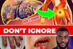 15 Strange Early Signs of Liver Failure That Even Doctors Don’t Know