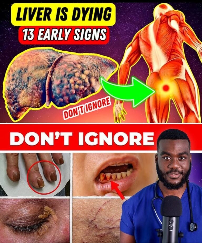 15 Strange Early Signs of Liver Failure That Even Doctors Don’t Know