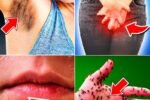 20 Silent Signs You May Have Diabetes Without Knowing