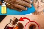 🌿 Apply Just One Drop: A Gentle Natural Oil Remedy to Fade Age Spots Naturally ✨