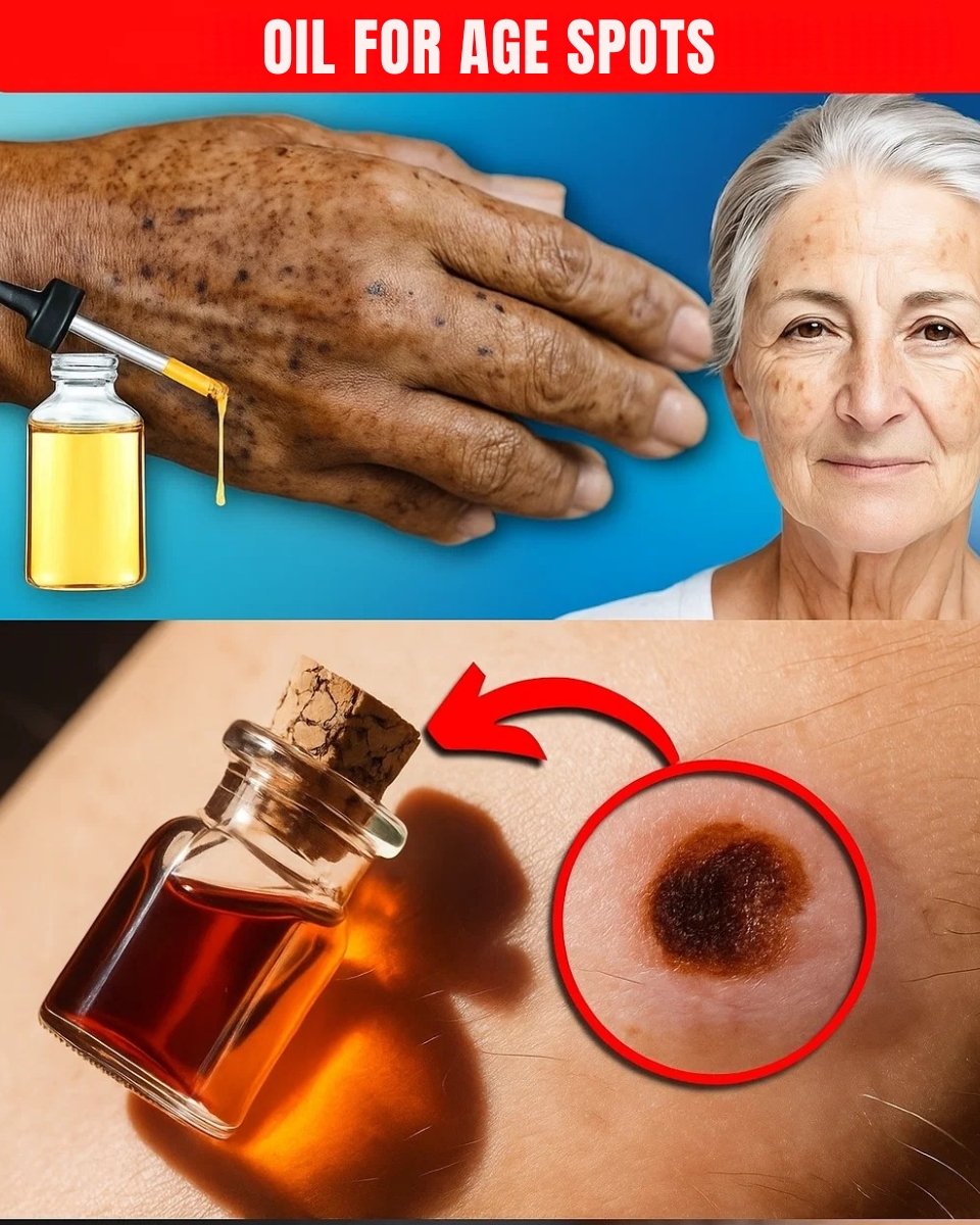 🌿 Apply Just One Drop: A Gentle Natural Oil Remedy to Fade Age Spots Naturally ✨